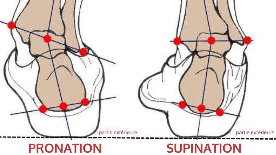 Déformation corporelle